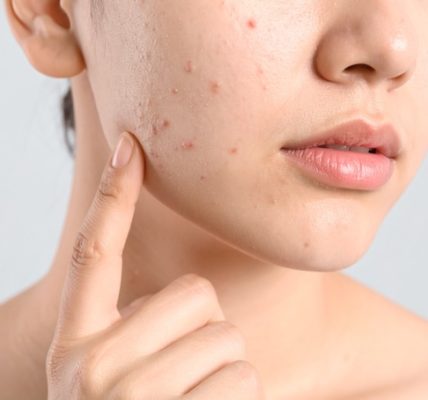 Bare glowing summer skin by looking out for these common skin woes MakatiMed